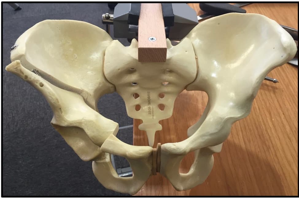 A model of the pelvis on a stand, with cuts made around one hip socket