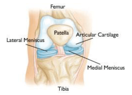 Illustration of the front of a knee, labeling the femur, patella, articular cartilage, lateral and medial menisci, and tibia
