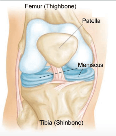 Illustration of the front of a knee, labeling the femur, patella, meniscus and tibia