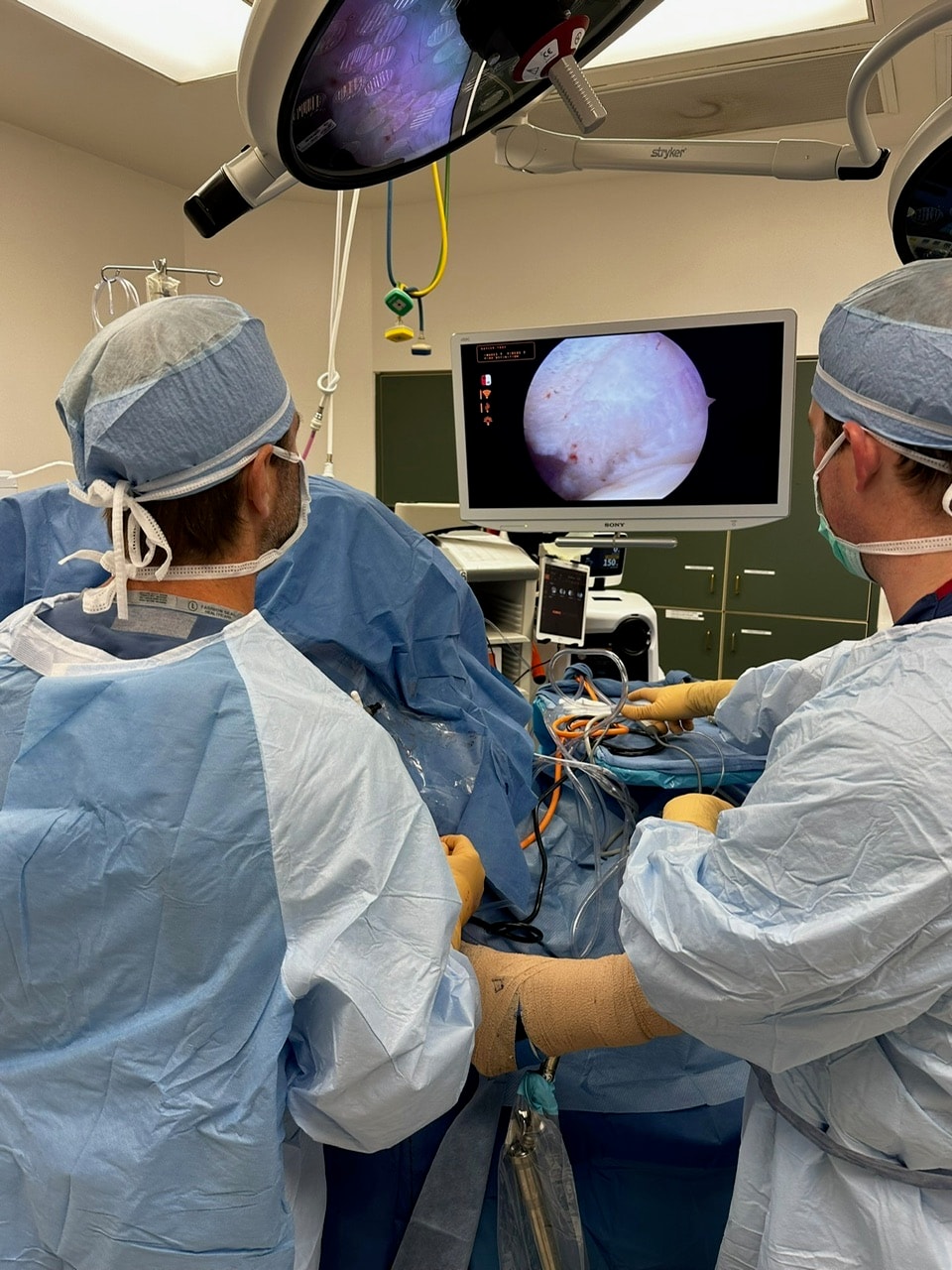 Dr. Jason Jones and his surgical team during an arthroscopic procedure, with the joint on the monitor above
